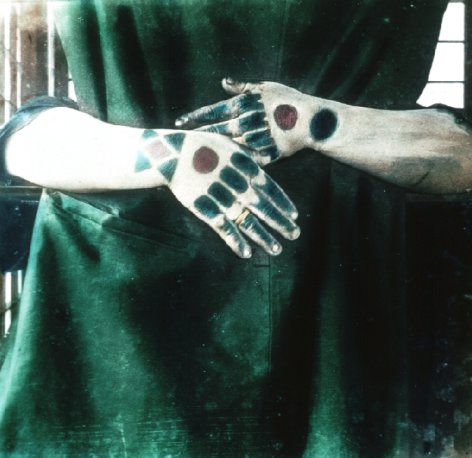 Tatoo-marks on the hands of Loo Chooan women